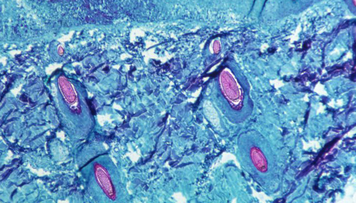 news-image